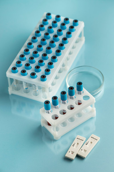 Veszprém PCR covid teszt